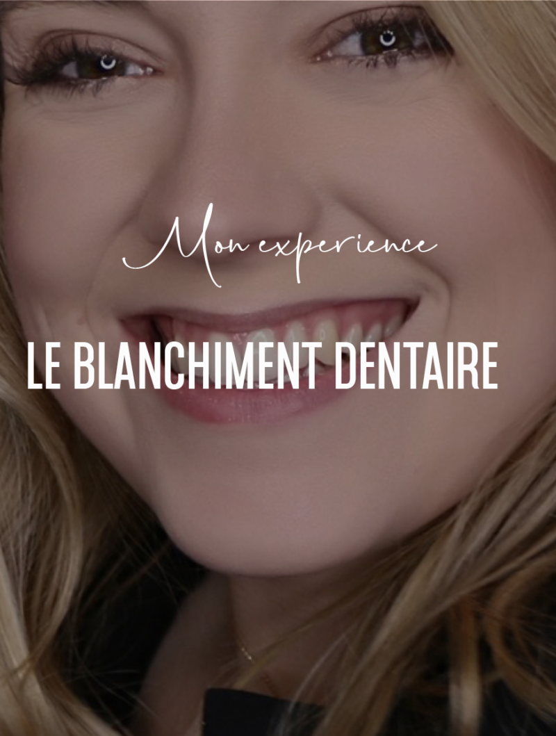 Mon expérience : Blanchiment dentaire
